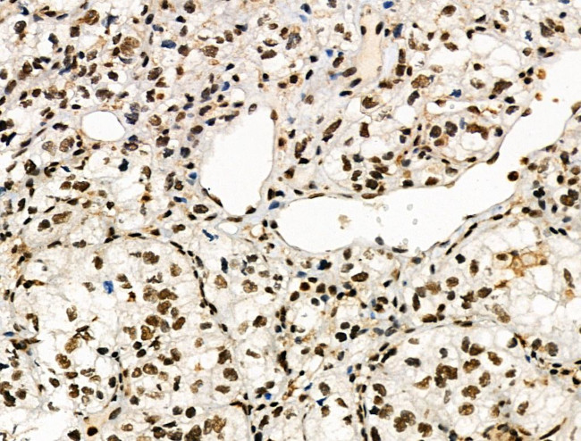 Phospho-POLR2A (Ser1616) Antibody in Immunohistochemistry (Paraffin) (IHC (P))