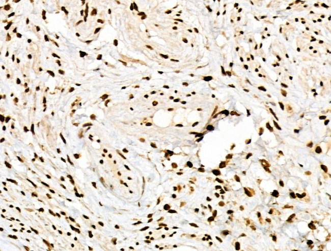 Phospho-POLR2A (Ser1616) Antibody in Immunohistochemistry (Paraffin) (IHC (P))