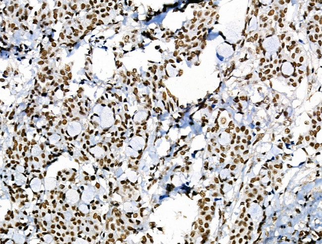 Phospho-POLR2A (Ser1616) Antibody in Immunohistochemistry (Paraffin) (IHC (P))