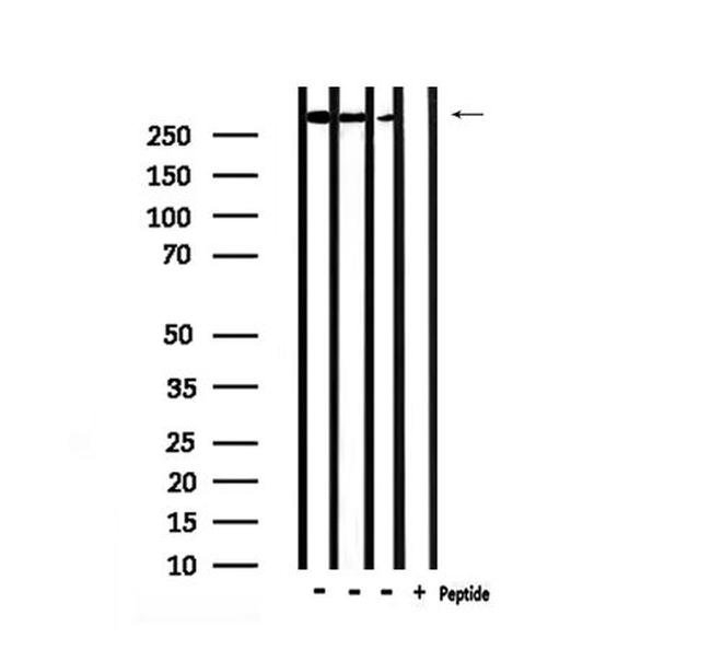 Phospho-POLR2A (Ser1616) Antibody in Western Blot (WB)