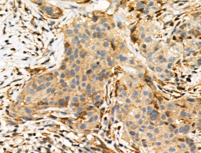 Phospho-TSC2 (Ser1254) Antibody in Immunohistochemistry (Paraffin) (IHC (P))