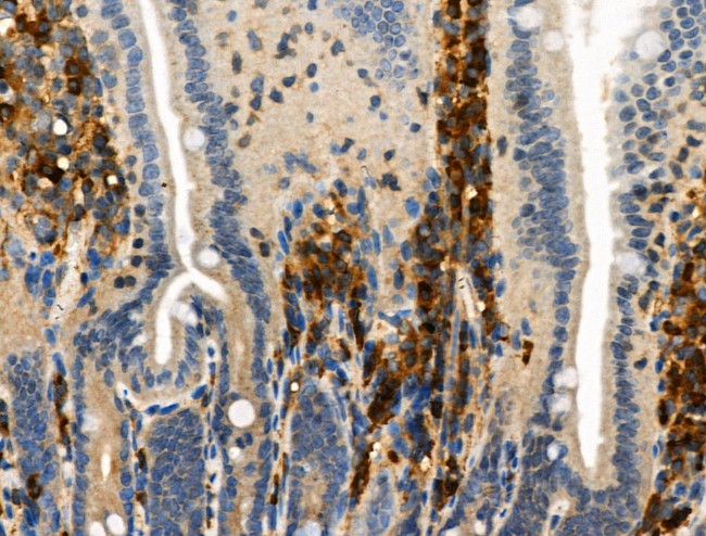 Phospho-TSC2 (Ser1254) Antibody in Immunohistochemistry (Paraffin) (IHC (P))