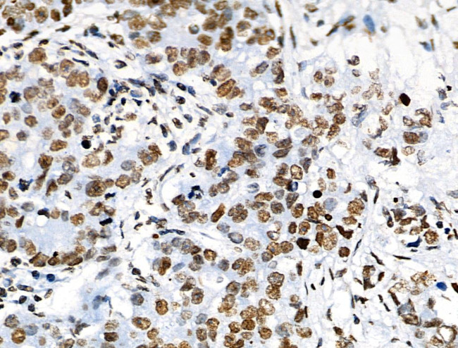 Phospho-ABI1 (Tyr213) Antibody in Immunohistochemistry (Paraffin) (IHC (P))