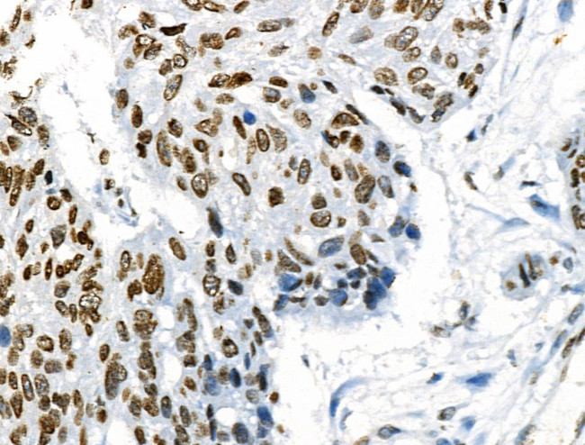 Phospho-ABI1 (Tyr213) Antibody in Immunohistochemistry (Paraffin) (IHC (P))