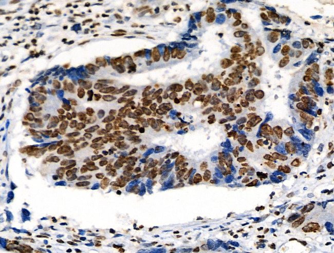 Phospho-ABI1 (Tyr213) Antibody in Immunohistochemistry (Paraffin) (IHC (P))