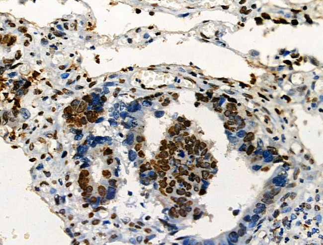 Phospho-ABI1 (Tyr213) Antibody in Immunohistochemistry (Paraffin) (IHC (P))