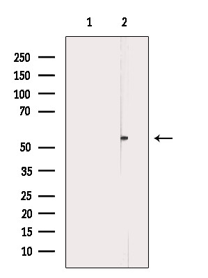 Phospho-ABI1 (Tyr213) Antibody in Western Blot (WB)