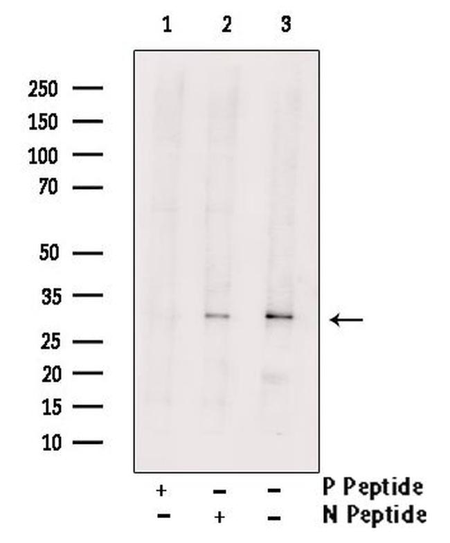 Phospho-CDK5 (Ser159) Antibody in Western Blot (WB)