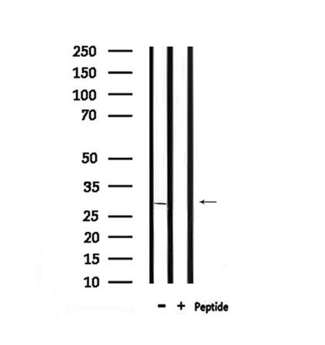 Phospho-CDK5 (Ser159) Antibody in Western Blot (WB)