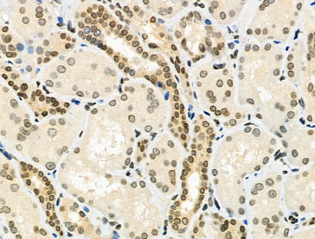 Phospho-E2F1 (Ser364) Antibody in Immunohistochemistry (Paraffin) (IHC (P))