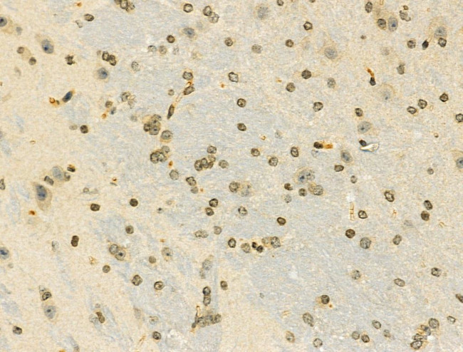 Phospho-E2F1 (Ser364) Antibody in Immunohistochemistry (Paraffin) (IHC (P))