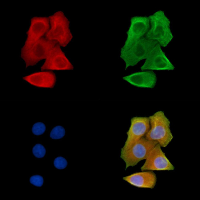 Phospho-GABBR2 (Ser884) Antibody in Immunocytochemistry (ICC/IF)