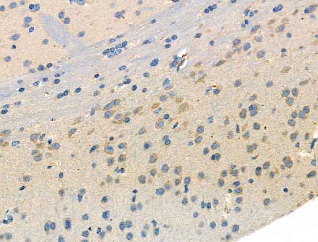 Phospho-GABBR2 (Ser884) Antibody in Immunohistochemistry (Paraffin) (IHC (P))