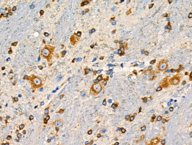 Phospho-GABBR2 (Ser893) Antibody in Immunohistochemistry (Paraffin) (IHC (P))