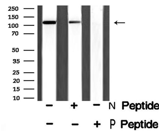 Phospho-GABBR2 (Ser893) Antibody in Western Blot (WB)