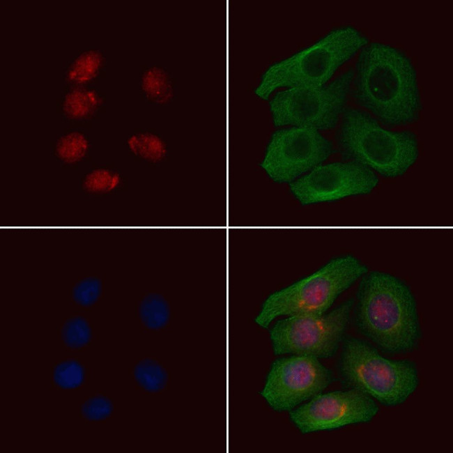 Phospho-IRF5 (Ser437) Antibody in Immunocytochemistry (ICC/IF)