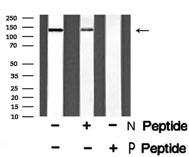 Phospho-TRKB (Tyr817) Antibody in Western Blot (WB)