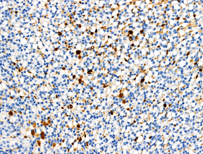 Phospho-TRKB (Tyr817) Antibody in Immunohistochemistry (Paraffin) (IHC (P))