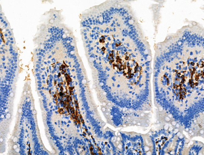 Phospho-TRKB (Tyr817) Antibody in Immunohistochemistry (Paraffin) (IHC (P))