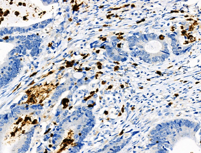 Phospho-CEACAM1 (Ser508) Antibody in Immunohistochemistry (Paraffin) (IHC (P))