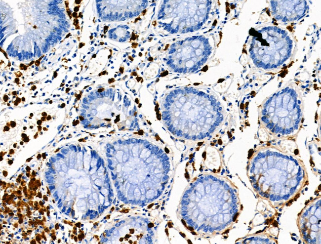 Phospho-CEACAM1 (Ser508) Antibody in Immunohistochemistry (Paraffin) (IHC (P))