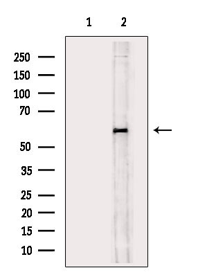 Phospho-CEACAM1 (Ser508) Antibody in Western Blot (WB)