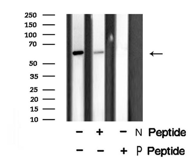 Phospho-DRP1 (Thr509) Antibody in Western Blot (WB)