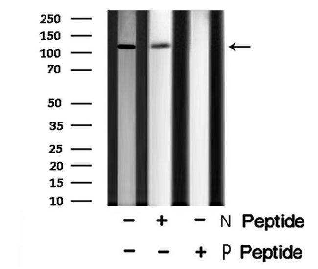 Phospho-EphA1 (Tyr605) Antibody in Western Blot (WB)