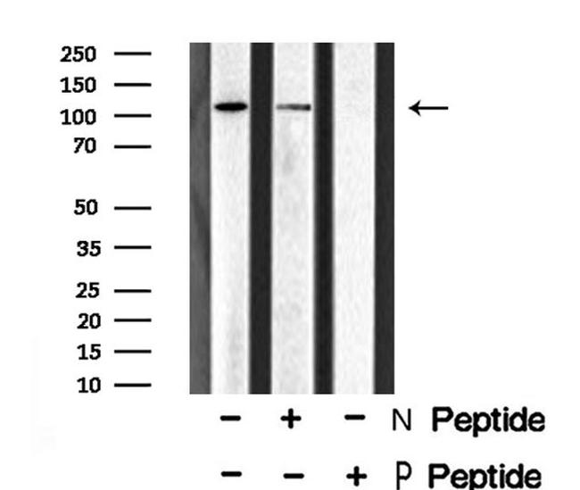 Phospho-EphA1 (Tyr781) Antibody in Western Blot (WB)