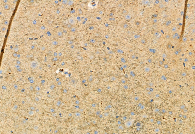 Phospho-FGFR2 (Ser782) Antibody in Immunohistochemistry (Paraffin) (IHC (P))