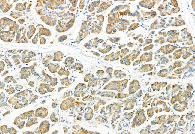 Phospho-FGFR2 (Ser782) Antibody in Immunohistochemistry (Paraffin) (IHC (P))