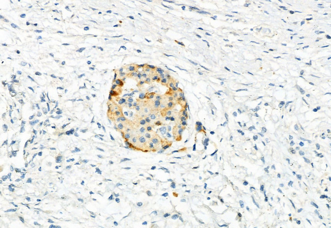 Phospho-FGFR2 (Ser782) Antibody in Immunohistochemistry (Paraffin) (IHC (P))