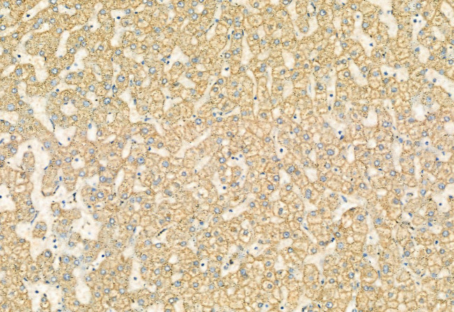 Phospho-FGFR2 (Ser782) Antibody in Immunohistochemistry (Paraffin) (IHC (P))