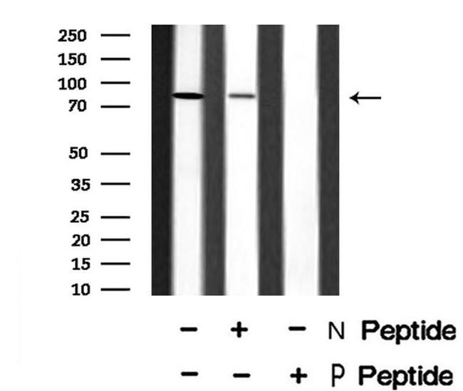 Phospho-FGFR2 (Ser782) Antibody in Western Blot (WB)