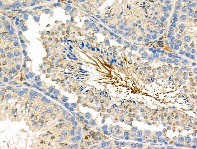 Phospho-FGFR3 (Tyr577) Antibody in Immunohistochemistry (Paraffin) (IHC (P))