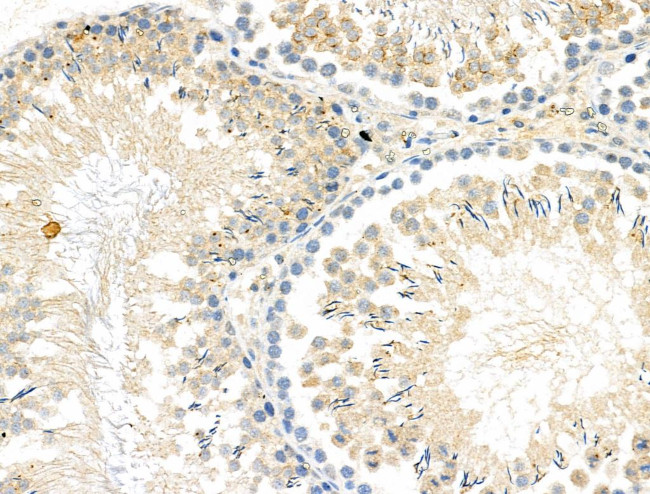 Phospho-FGFR3 (Tyr577) Antibody in Immunohistochemistry (Paraffin) (IHC (P))