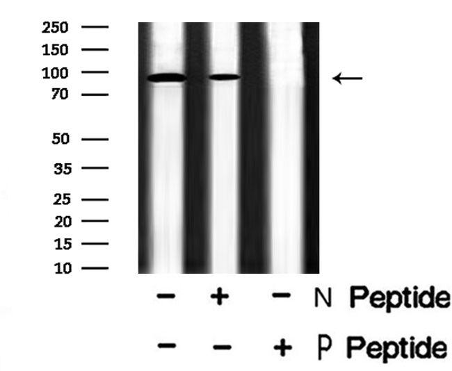 Phospho-FGFR3 (Tyr577) Antibody in Western Blot (WB)