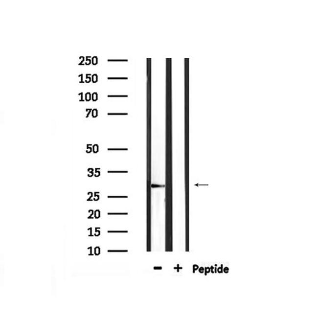 Phospho-LAT (Tyr255) Antibody in Western Blot (WB)