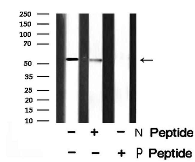 Phospho-SMAD1/SMAD9 (Ser463, Ser465) Antibody in Western Blot (WB)