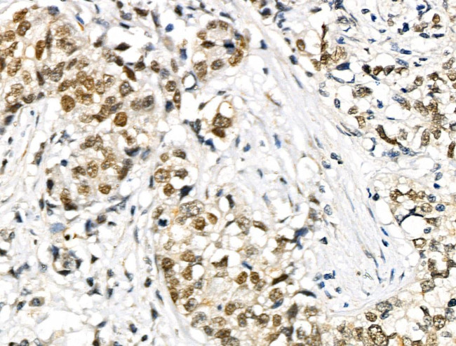 Phospho-SMAD1/SMAD9 (Ser463, Ser465) Antibody in Immunohistochemistry (Paraffin) (IHC (P))