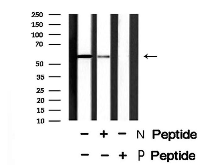 Phospho-TGFBR1 (Thr204) Antibody in Western Blot (WB)