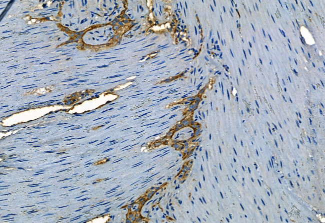 Phospho-TGFBR1 (Thr204) Antibody in Immunohistochemistry (Paraffin) (IHC (P))