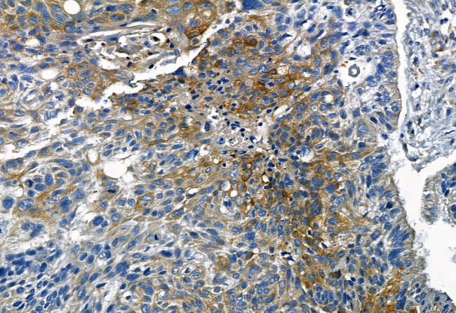 Phospho-TGFBR1 (Thr204) Antibody in Immunohistochemistry (Paraffin) (IHC (P))