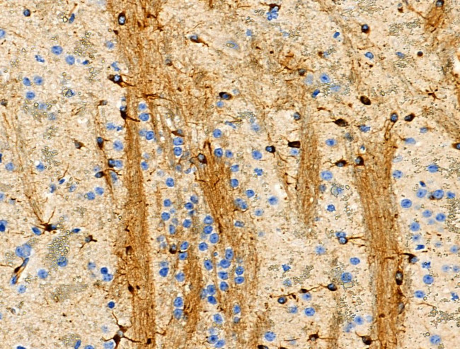 Phospho-BCL-2 (Thr74) Antibody in Immunohistochemistry (Paraffin) (IHC (P))