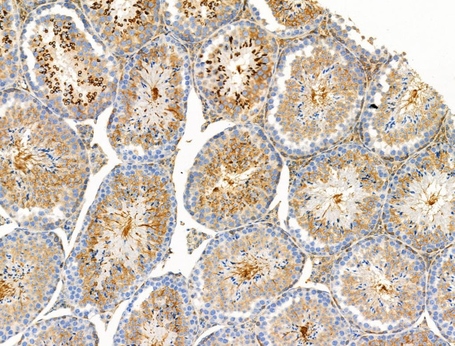 Phospho-BCL-2 (Thr74) Antibody in Immunohistochemistry (Paraffin) (IHC (P))