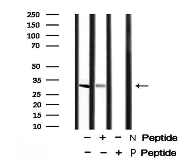 Phospho-BCL-2 (Thr74) Antibody in Western Blot (WB)