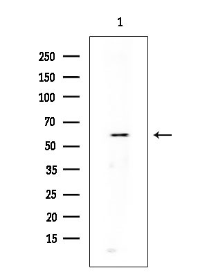Phospho-DNM1L (Ser616) Antibody in Western Blot (WB)