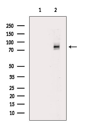 Phospho-DNM1L (Ser616) Antibody in Western Blot (WB)