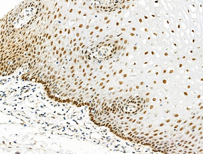 Phospho-eIF2 beta (Ser2) Antibody in Immunohistochemistry (Paraffin) (IHC (P))