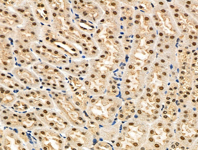 Phospho-eIF2 beta (Ser2) Antibody in Immunohistochemistry (Paraffin) (IHC (P))